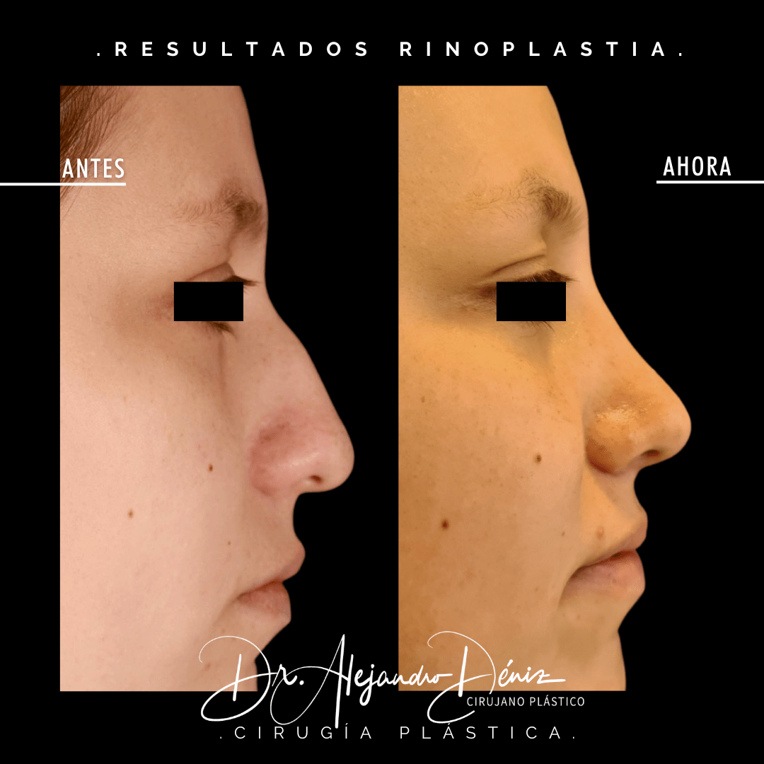 Copia de 3 3