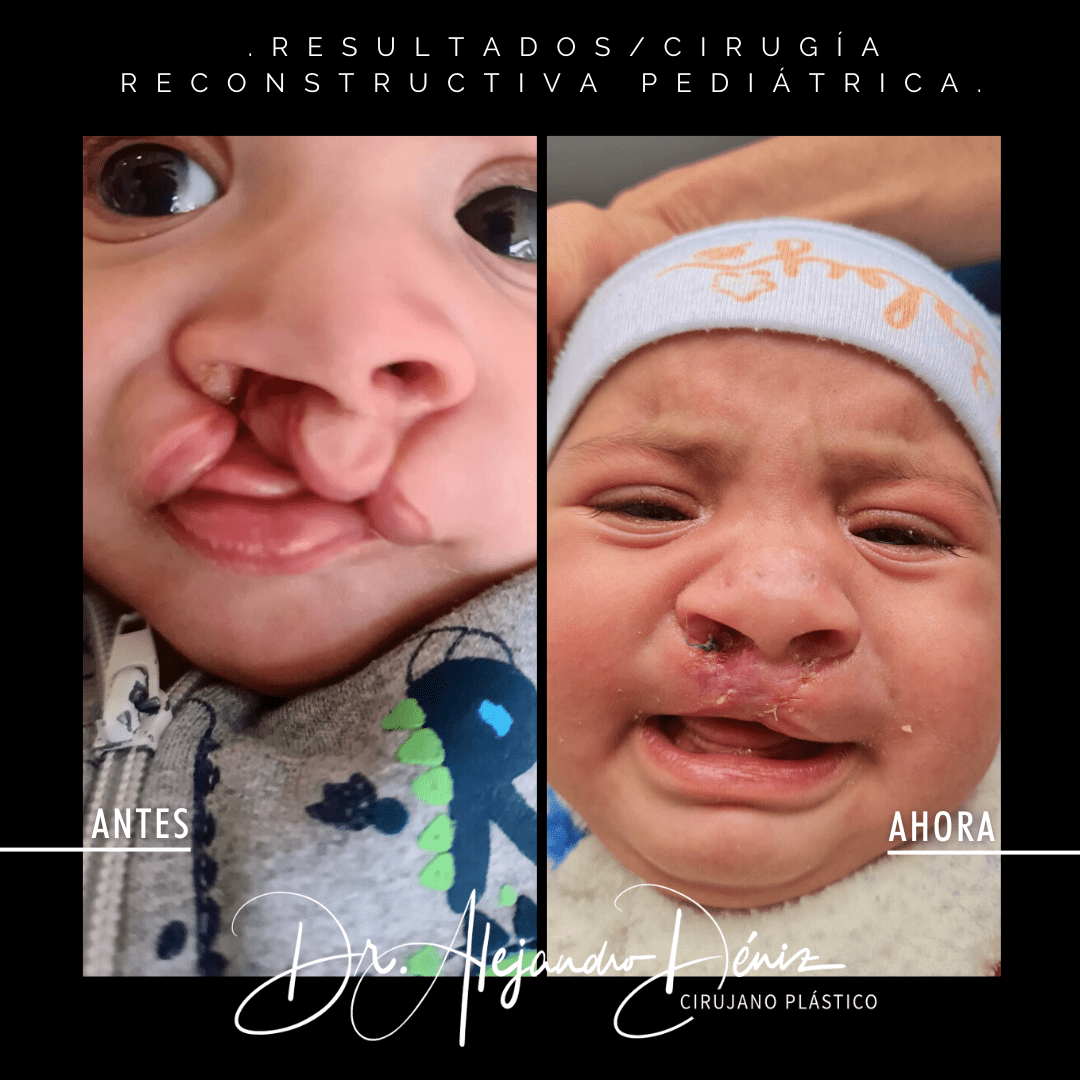 reconstructiva-3